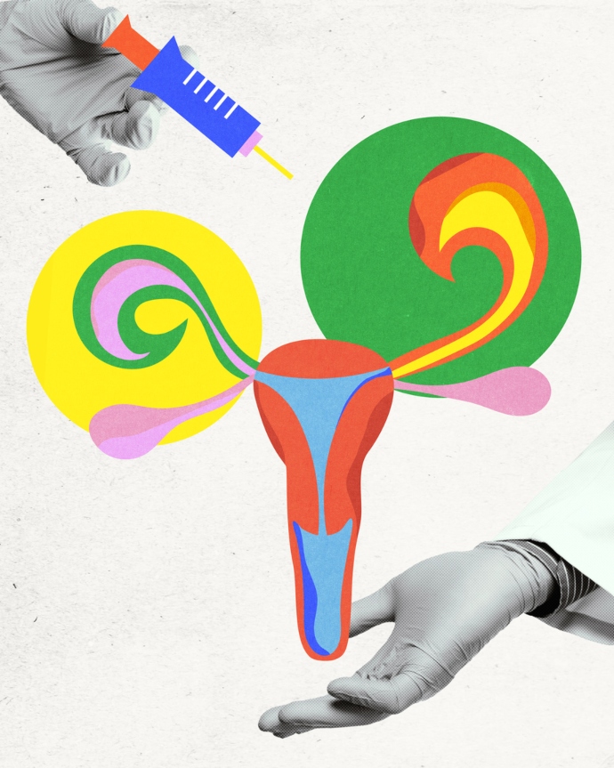 Η «σιωπηλή» ενδομητρίωση χτυπά χωρίς πόνο. Ποια σημάδια δεν πρέπει να αγνοείς;