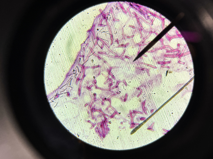 spicules, σκληρίτες