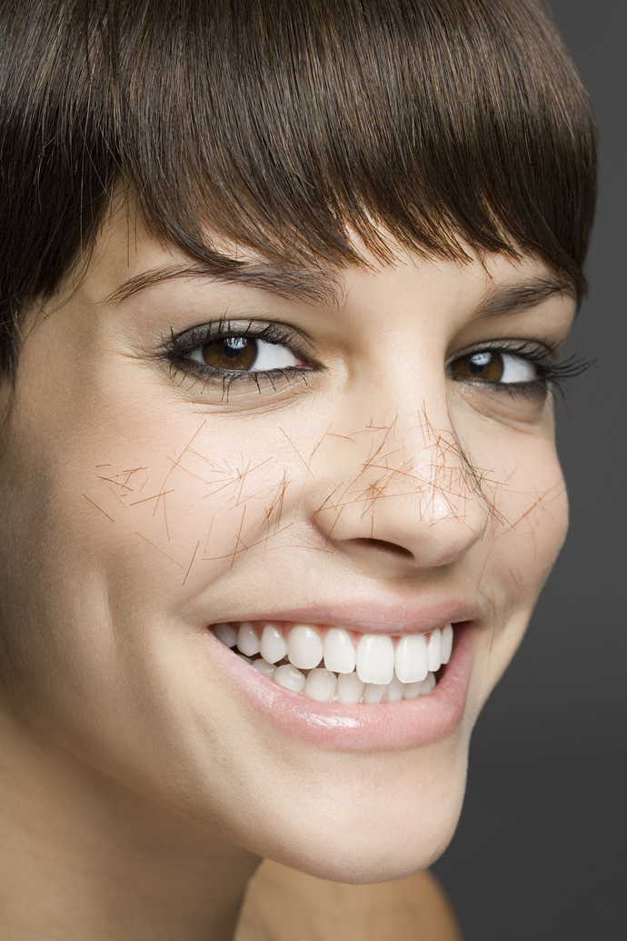 σκληρίτες, spicules 